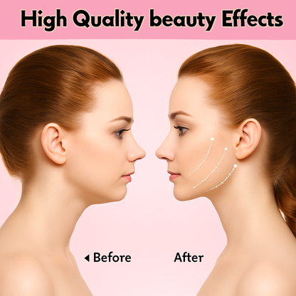 (Súper Oferta) Máscara V-Line Para Afinar El Rostro